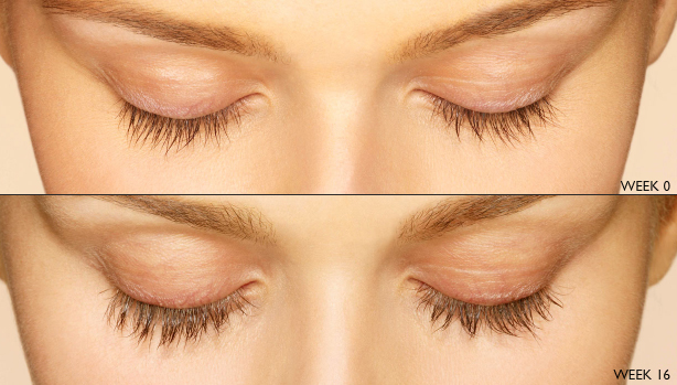 Before & 16 weeks after Latisse