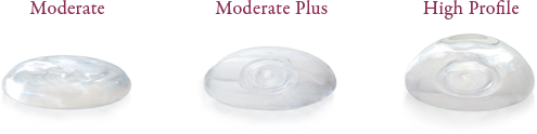 Breast implant profiles increase in height from moderate to moderate plus to high profile