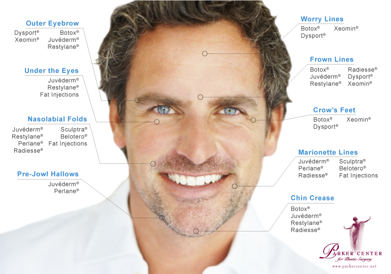 Male face with common concerns highlighted and appropriate injectables listed to address them