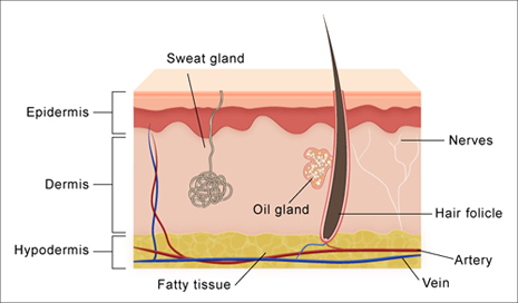 Skin diagram showing epidermis, dermis, and hypodermis