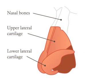 Nose anatomy illustration showing nasal bones, upper lateral cartilage, and lower later cartilage