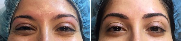 Semi-Permanent Eye Makeup With Ally