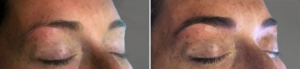 Before & After Eyebrow Microblading With Ally
