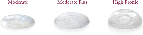 Breast implant profile examples