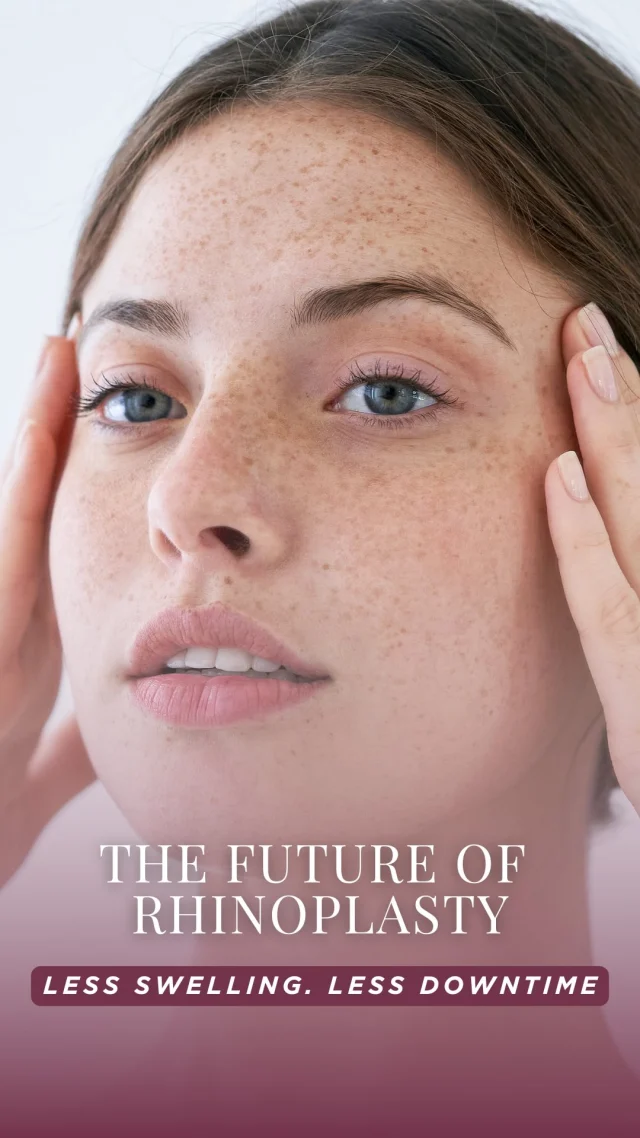 Not your average nose job 👃⚡️

This is Piezoelectric Ultrasonic Rhinoplasty—and it’s changing the game.

💥 More precision
💥 Less trauma
💥 Faster healing
💥 Smoother, more natural results

Unlike traditional tools, Piezo uses ultrasonic vibrations to sculpt bone without damaging surrounding tissue. That means less bruising, less swelling, and a smoother recovery. 

👇 Drop your questions or comment “RHINOPLASTY” for more info ✨

#UltrasonicRhinoplasty #PiezoRhinoplasty #DrPaulParker #RhinoplastyExpert #ParamusNJ #NaturalNoseJob #RhinoplastyRecovery #plasticsurgery #ScarlessNoseJob #FacialHarmony #NorthJerseyBeauty #plasticsurgeon #njplasticsurgery #bergencounty #bergencountymoms