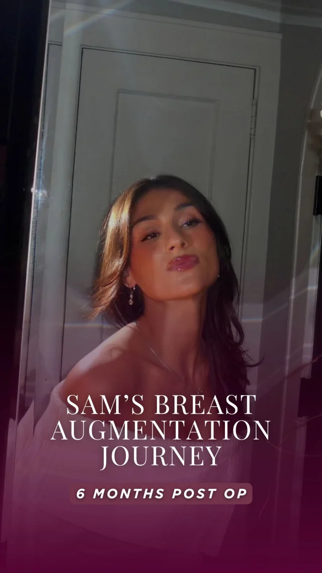 Sam is officially 6 months post breast augmentation and she couldn’t be happier with her results 💗

She shared that her recovery was surprisingly easy (almost pain-free!) and she felt confident every step of the way thanks to the support from our team.

From consultation → recovery → results… this journey is all about feeling empowered in your own body.

Ready to explore your options? ✨

Book your consultation at The Parker Center for Plastic Surgery.
______________________
☎️ (201) 967-1212
🗺 122 E Ridgewood Ave, Paramus, NJ 07652
📍 Parker Center for Plastic Surgery is located in Paramus, New Jersey, conveniently located 40 minutes from New York City.
 #breastaugmentation #plasticsurgery #paramusnj #beforeandaftertransformation #parkercenter #paramusnj