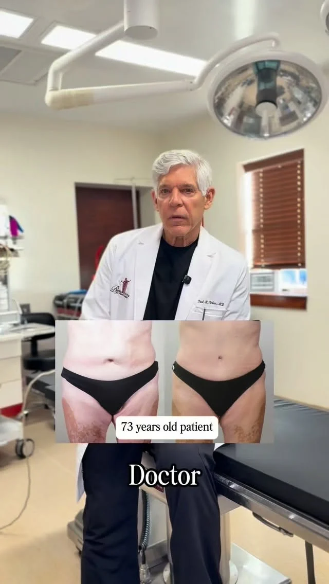 “Am I too old for a tummy tuck?”

The honest answer: it’s not about your age — it’s about your health.

A tummy tuck isn’t determined by the number on your birthday candle, but by your biological age, overall health, and goals. We’ve safely performed tummy tucks on patients in their 60s and even 70s who were excellent candidates.

If you’re healthy and ready to feel confident in your body again, age doesn’t have to be the limiting factor. ✨

📞 Schedule a consultation to find out what’s possible for you.

#TummyTuck #PlasticSurgeryEducation #AgeIsJustANumber #BodyConfidence #BoardCertifiedSurgeon #RealResults