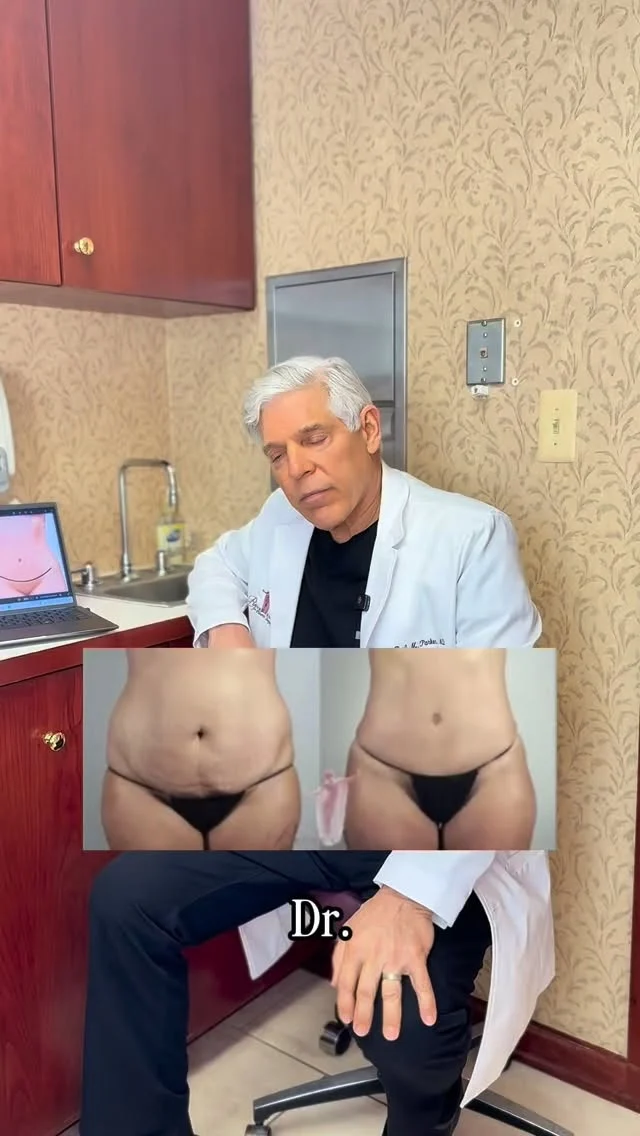 The details matter—especially the ones no one should be able to spot.

Dr. Parker shares how he creates the perfect belly button: natural, balanced, and designed to look like it was always yours. It’s not just about placement—it’s about technique, proportion, and precision.

This is the difference thoughtful surgery makes. ✨

Interested in a tummy tuck? Book your consultation today! 
☎️ (201) 967-1212
🗺 122 E Ridgewood Ave, Paramus, NJ 07652
📍 Parker Center for Plastic Surgery is located in Paramus, New Jersey, conveniently located 40 minutes from New York City 🌃 

#tummytuck #plasticsurgery #parkercenter #bergencounty #paramusnj