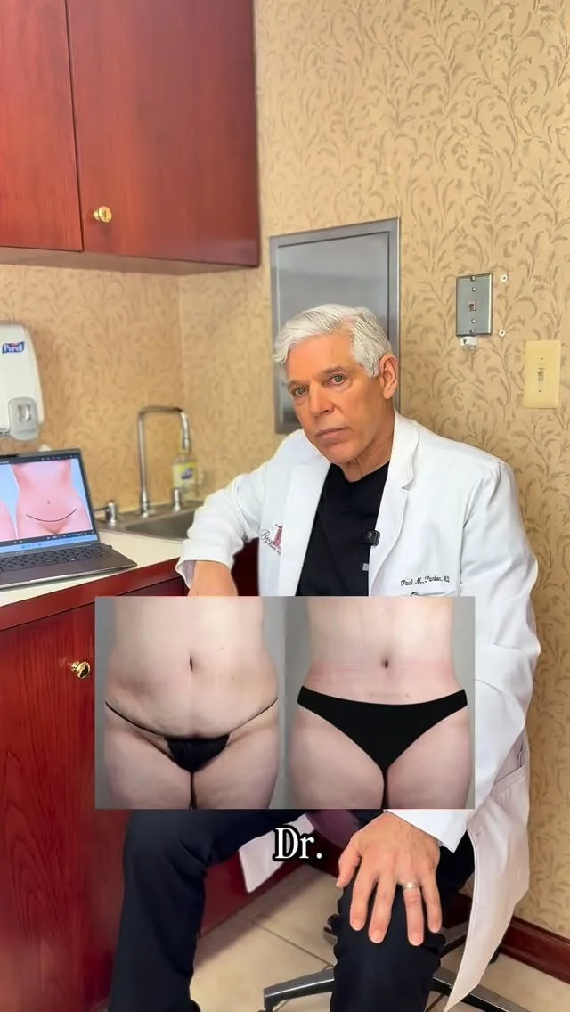 Pain is the #1 thing patients ask about when it comes to a tummy tuck — and Dr. Parker gets it.

In this video, Dr. Parker breaks down exactly how he minimizes discomfort before, during, and after surgery so your recovery is smoother and more manageable. From advanced surgical techniques to strategic pain management protocols, every step is intentional.

A comfortable recovery isn’t a luxury — it’s part of the plan.

Have questions about tummy tuck recovery? Drop them below or schedule a consultation to get personalized guidance.

☎️ (201) 967-1212
🗺 122 E Ridgewood Ave, Paramus, NJ 07652
📍 Parker Center for Plastic Surgery is located in Paramus, New Jersey, conveniently located 40 minutes from New York City.
#tummytuck #tummytuckbeforeandafter #plasticsurgery #bergencounty