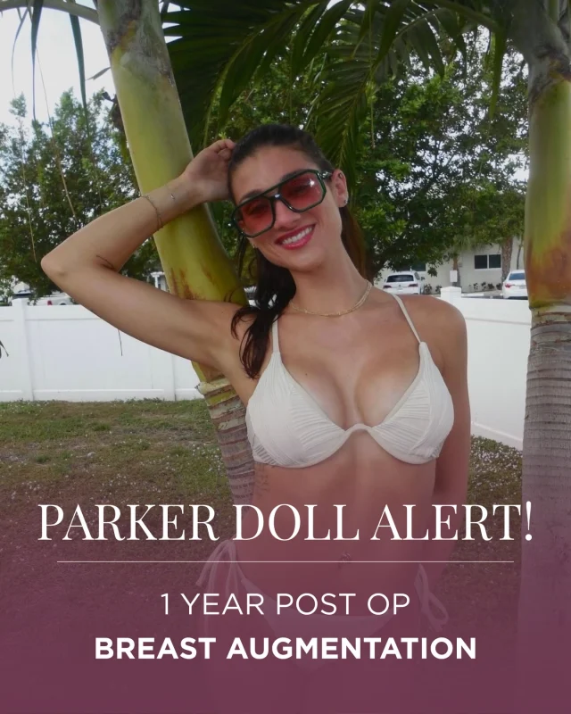 One year later and the confidence says it all. ✨

Sam is officially 1 year post–breast augmentation, and seeing her this happy with her results is exactly why we love what we do.

At the one-year mark, implants have fully settled, scars continue to soften, and the final shape truly comes into its own. It’s when patients often feel the most like themselves again—just with the result they envisioned.

Sam’s journey is a reminder that breast augmentation isn’t just about volume. It’s about proportion, balance, and helping you feel confident in your own skin.

And when patients come back smiling like this… we know we achieved exactly that.

Thinking about breast augmentation but not sure where to start? Call to book a consultation to talk through your goals and see what’s possible for you! ✨
☎️ (201) 967-1212
🗺 122 E Ridgewood Ave, Paramus, NJ 07652

#breastaugmentation #breastaugmentationbeforeandafter #plasticsurgery #paramusnj