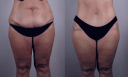 0_pcmommymakeovernewjerseyfrontbeforeafter.gif